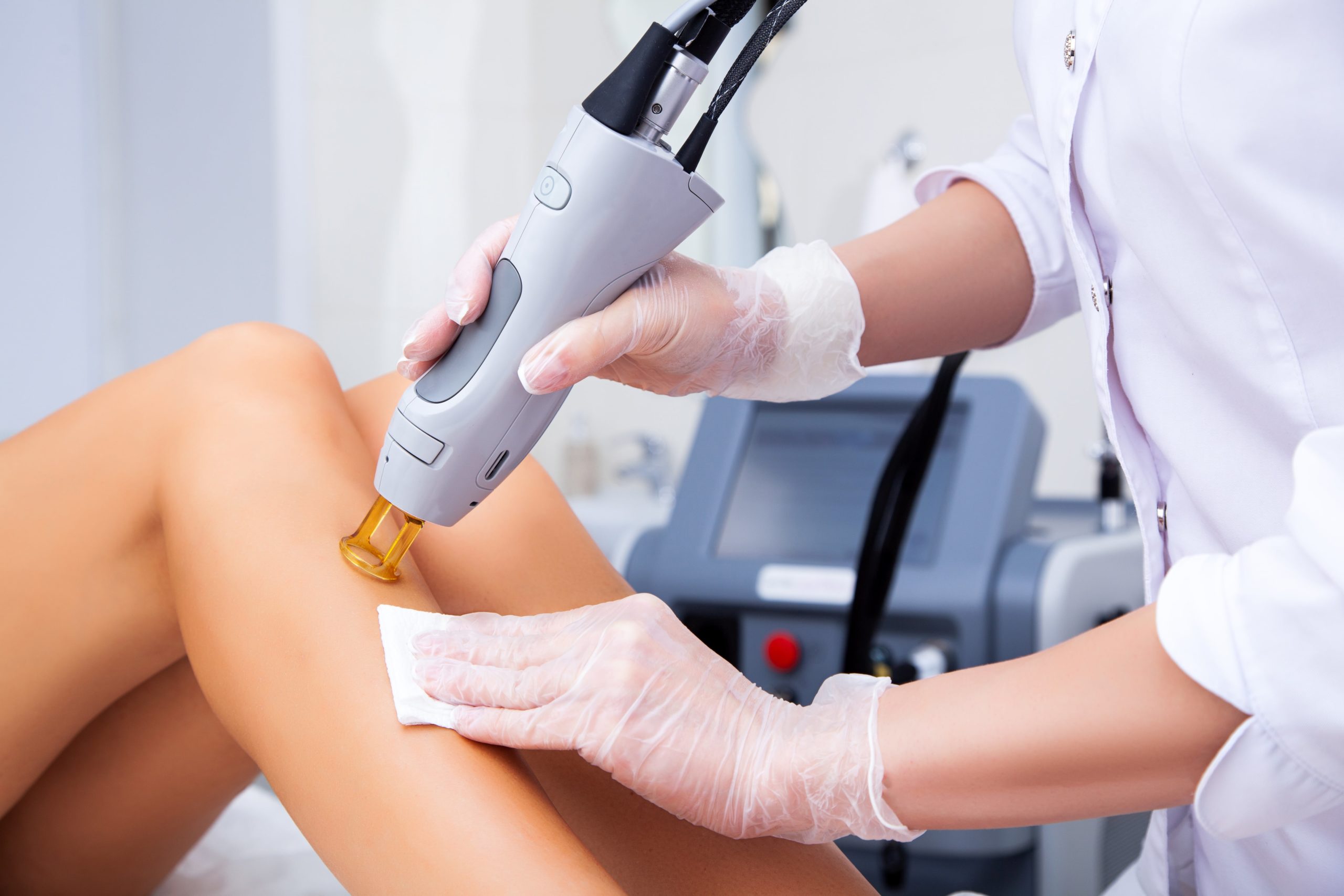 What is Laser Hair Removal And How Does It Work