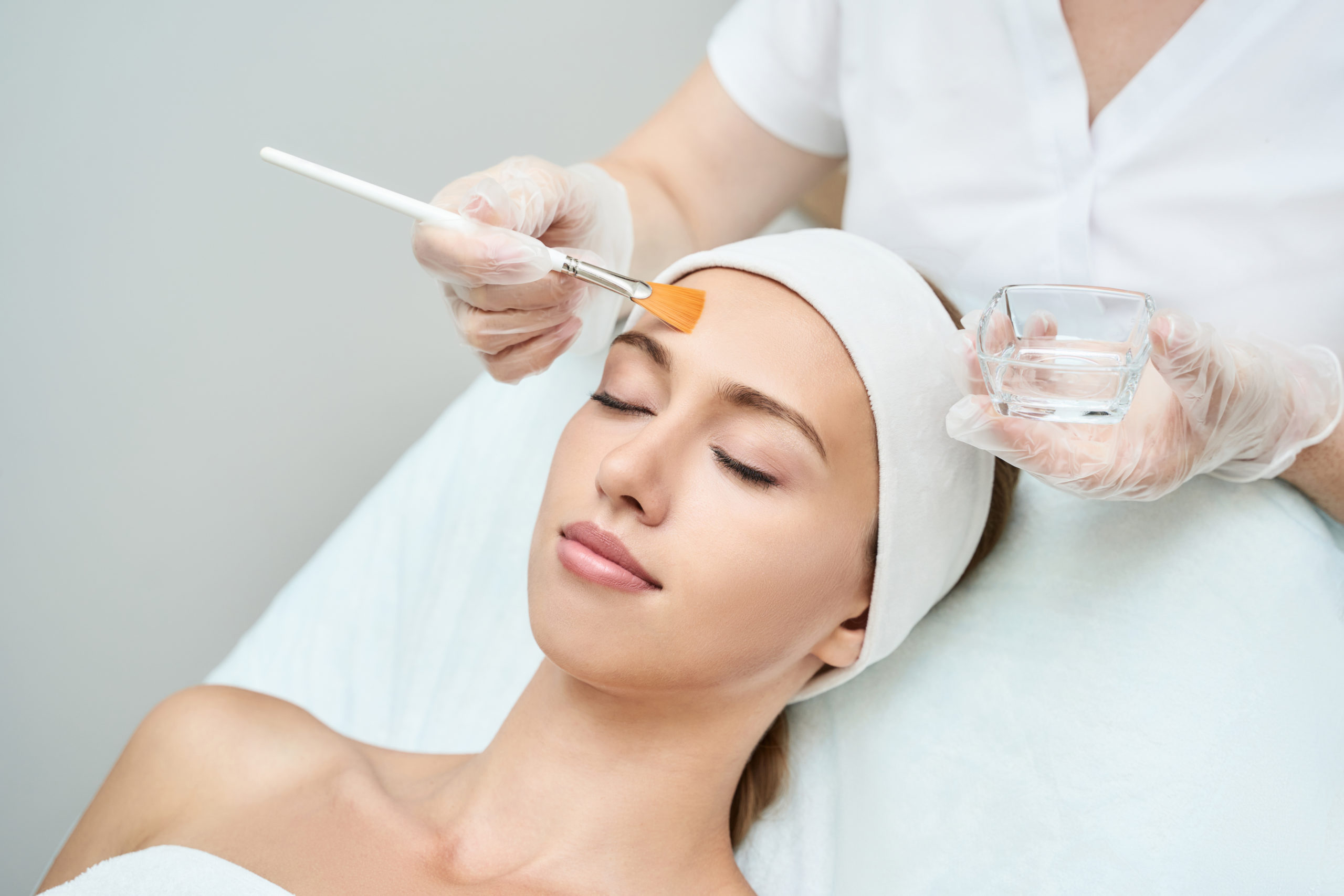Unveiling the Benefits of Chemical Peel Treatment