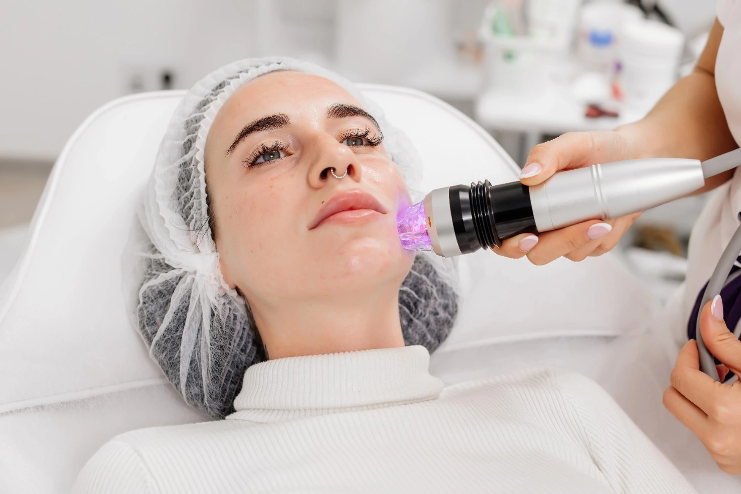 Microneedling Treatment at Revive Med Spa