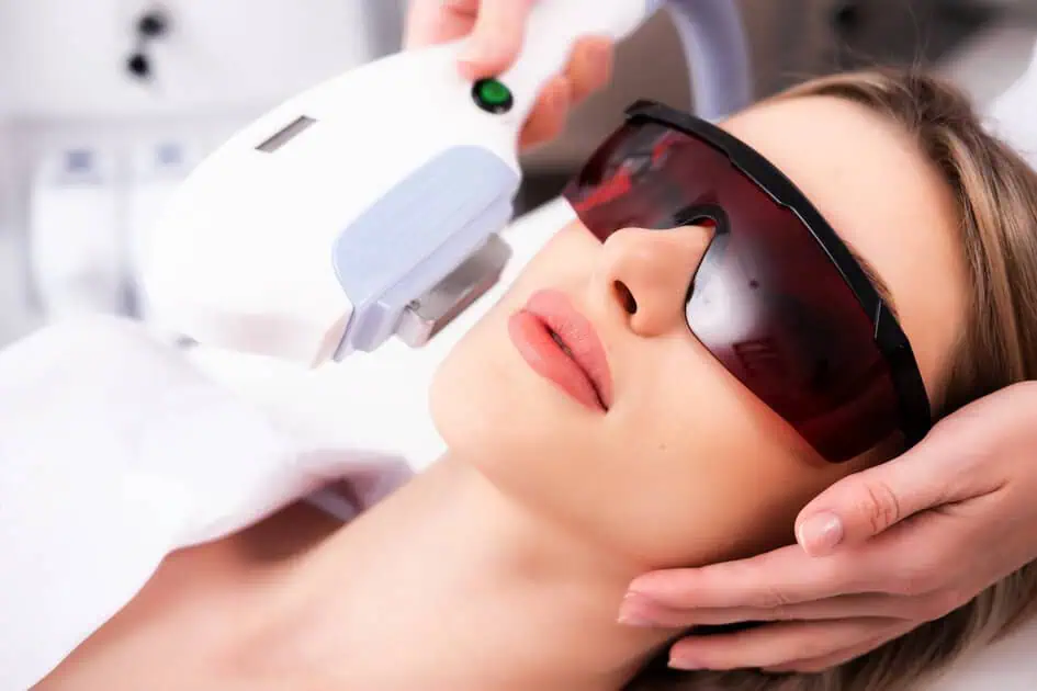 CoolPeel Treatment by Revive Med Aesthetics in Fredericksburg, VA