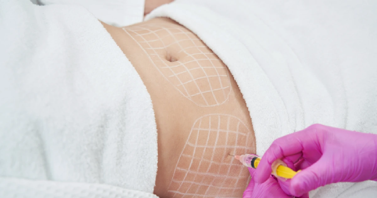 Women Receiving Liquid Lipo (PCDC) Injection in Fredericksburg, VA