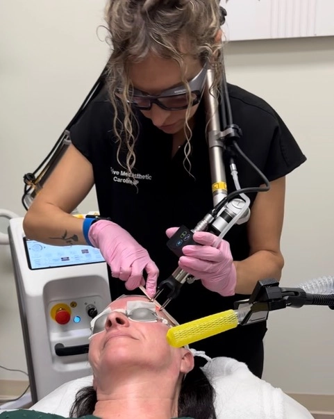 Aesthetician giving coolpeel laser treatment at Revive Med Aesthetics
